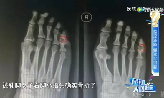 司机朋友注意!碰瓷新招别被套!